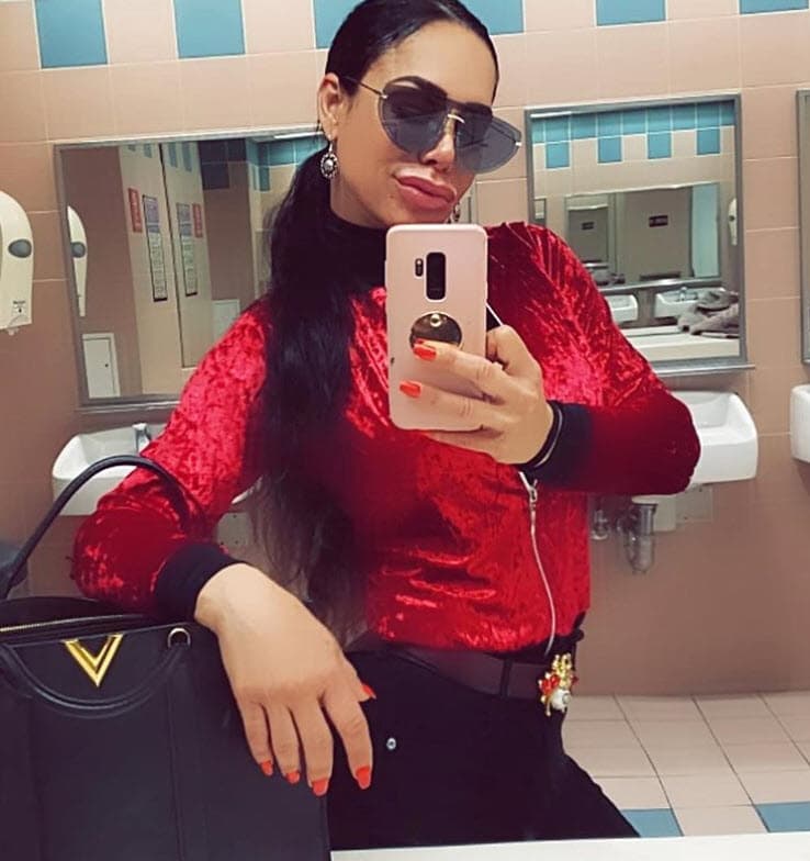 "Este cuerpo es terrenal y es prestado, lo que yo decida hacer con él mientras a mí me guste y me sienta bien, es una decisión personal; pero hay gente que le gusta, sino no crecerían tanto mis redes sociales", aseguró. Hasta la tarde de este miércoles 4 de marzo, su 
<b><a href="https://www.instagram.com/lisvegaoficial/" target="_blank">cuenta oficial de Instagram </a></b>registraba un millón de seguidores.
<br>