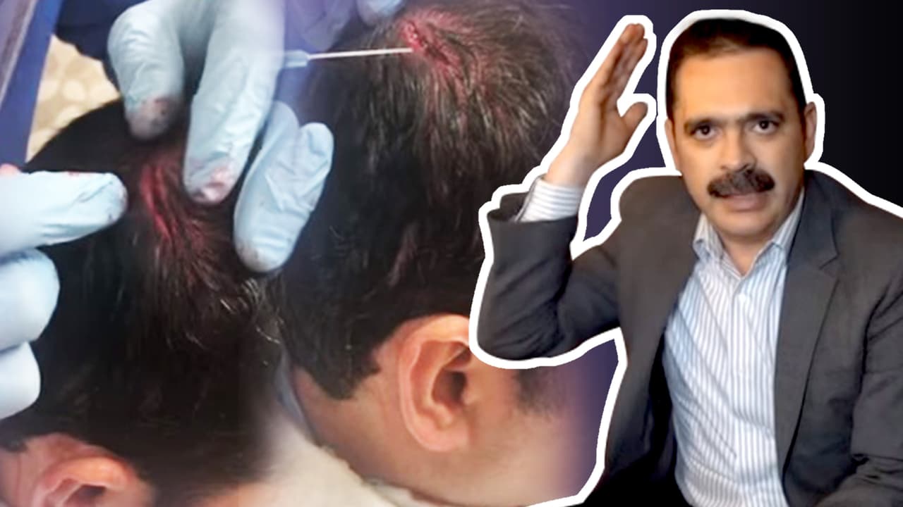 Una cortada de más de cuatro centímetros, el resultado del botellazo a Mario Quintero en el baile de Kentucky