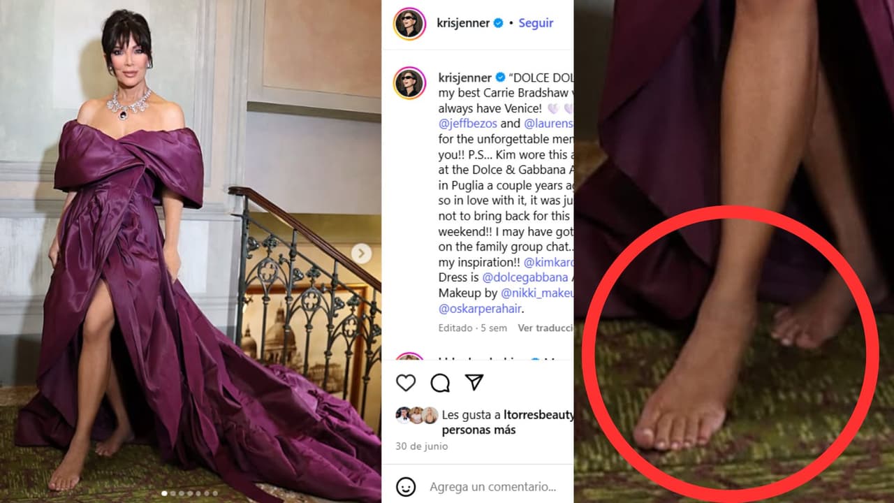 Kris Jenner ha publicado fotos de sus pies en los que se aprecia que tiene cinco dedos.