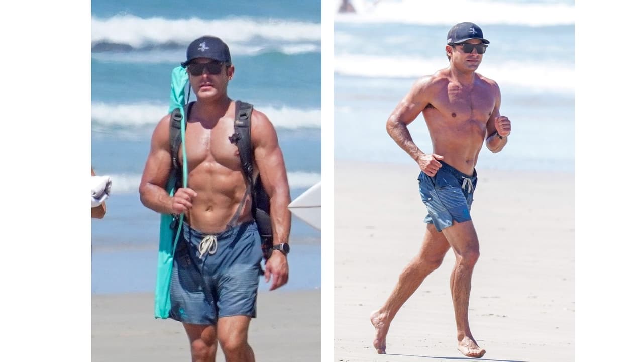 Con el paso del tiempo, parece que la transformación de Zac, más que ser resultado del bisturí, parece que fue un retoque con fillers o bótox, ya que el efecto ya no es tan notable.