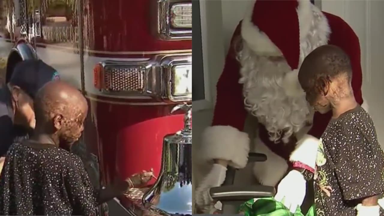 El cuerpo de bomberos de la ciudad de Miami, 
<a href="https://www.univision.com/local/miami-wltv/edicion-digital-miami/bomberos-de-miami-llevan-alegria-y-la-magia-de-la-navidad-a-nino-que-perdio-a-su-madre-en-un-incendio-video">llevó alegría y sonrisas a TJ Mack,</a> un niño de 6 años que sufrió graves quemaduras cuando su casa se incendió el pasado mes de abril.