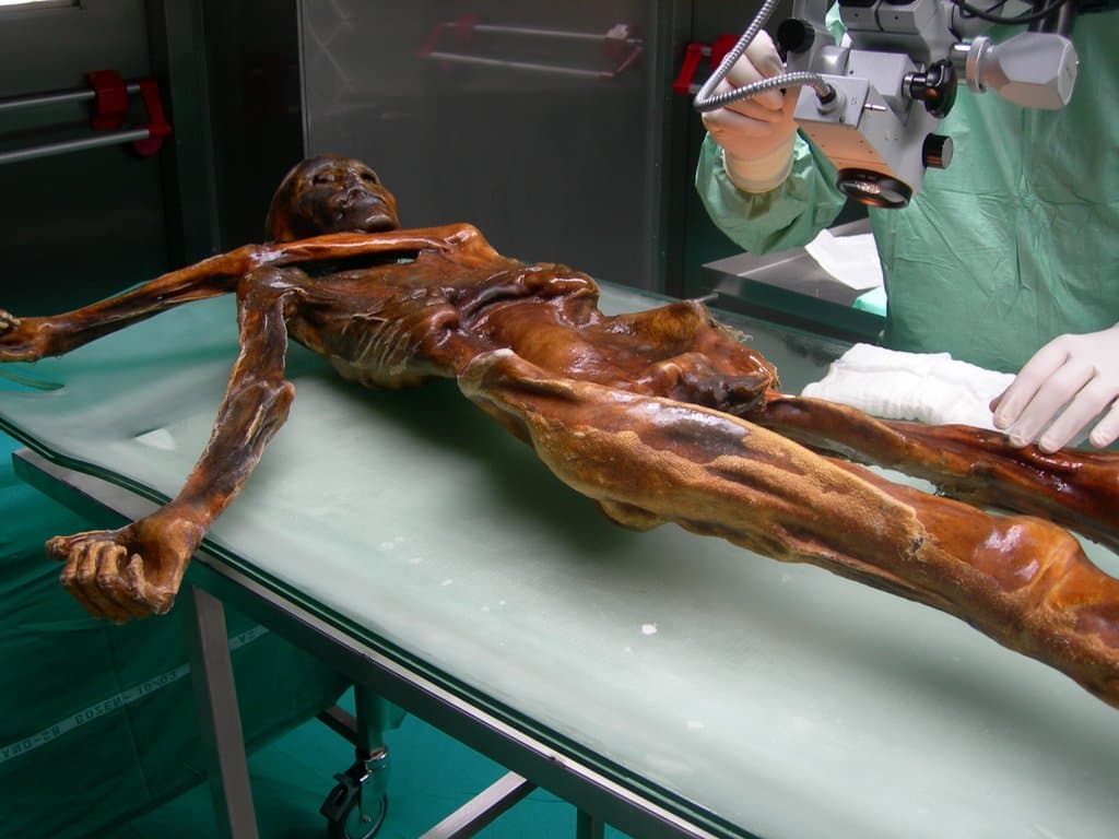 Un corte en su mano derecha que indica que hubo un combate cuerpo a cuerpo y Ötzi nunca tuvo la oportunidad de curarse antes de morir. Esto significa que la lucha ocurrió antes de que le dispararan, quizás horas o días antes y pudo haber llevado al segundo enfrentamiento que lo mató.