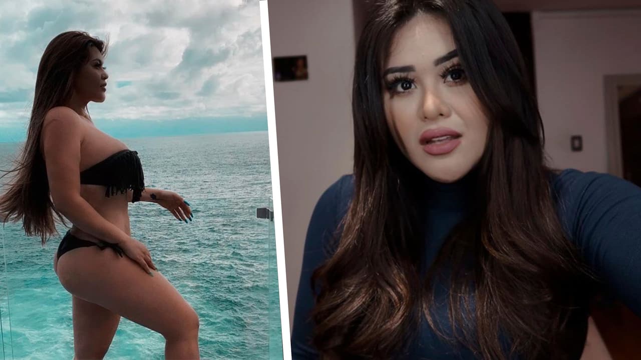 "Ya era mucho nalgatorio": 'Gomita' se retira sus implantes luego de críticas por verse desproporcionada