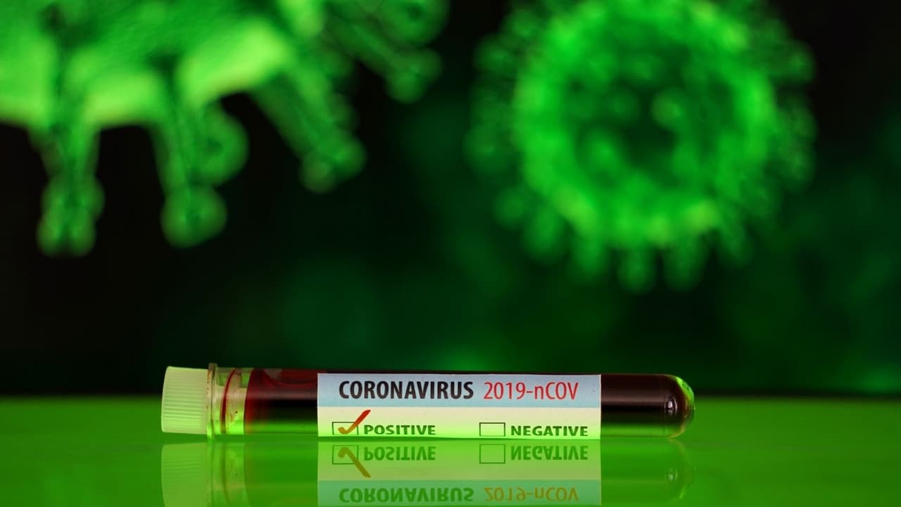 <b>Precaución</b>: mandato de vacunación (o prueba negativa dentro de las 24 horas) para la mayoría de los lugares; mandato de máscara.