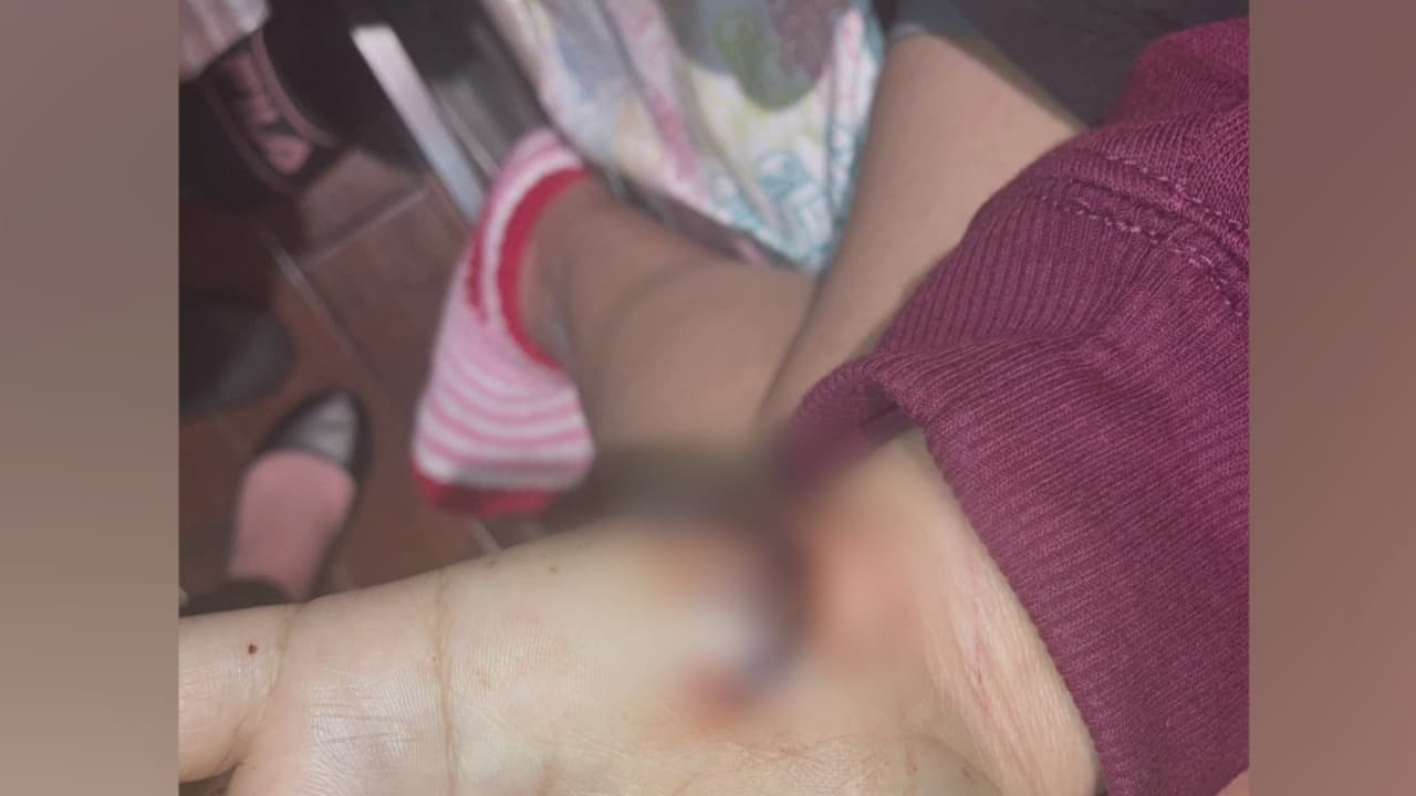 Una mujer de Dallas dice que un ataque por parte de su pareja casi le quita la vida