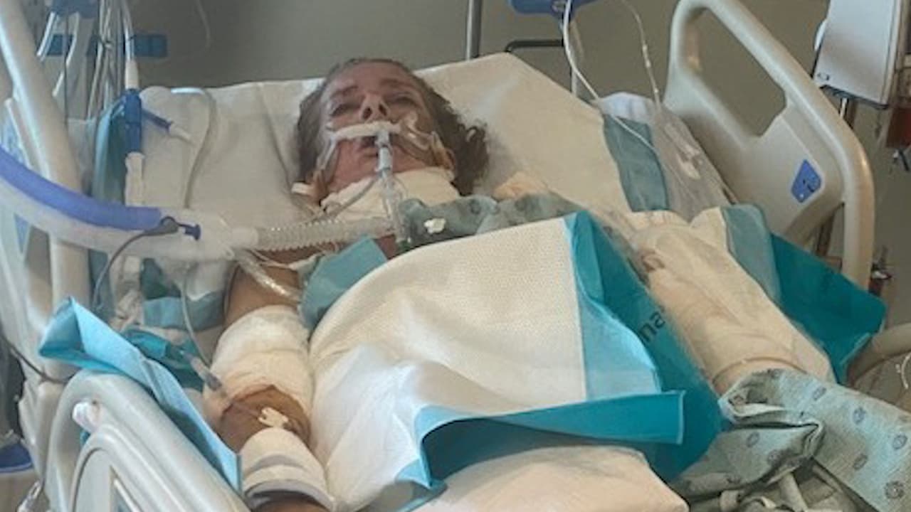 De acuerdo con su familia, Rebecca Hatcher fue agredida a mordiscos por tres o hasta cinco perros el 20 de junio.