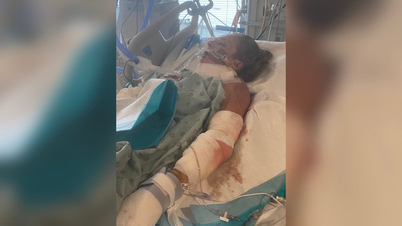 La familia de Rebeca no tiene idea de cuál será el costo de la atención en el hospital una vez que sea dada de alta.