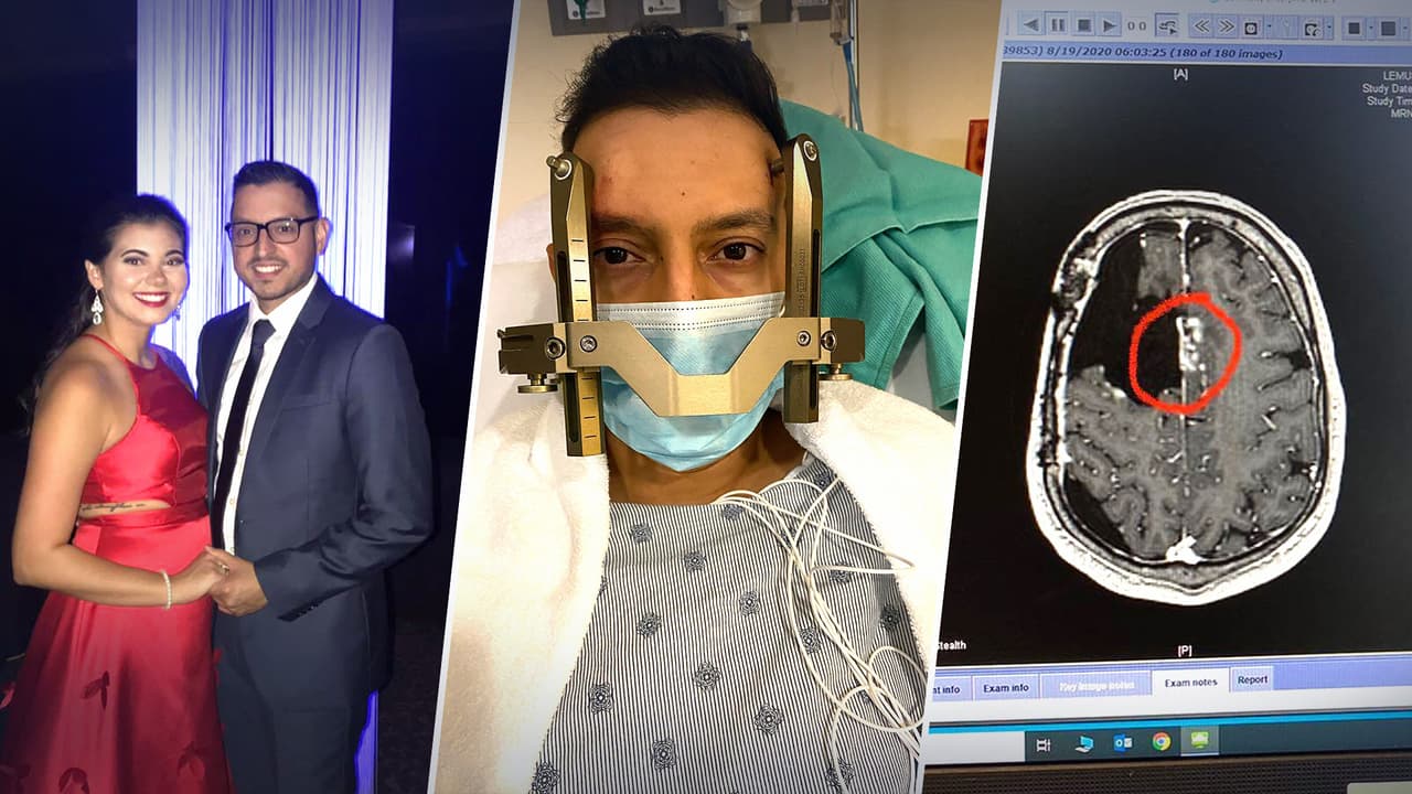 Le dieron dos meses de vida y han pasado seis años: hispano vive con mortal tumor cancerígeno en la cabeza