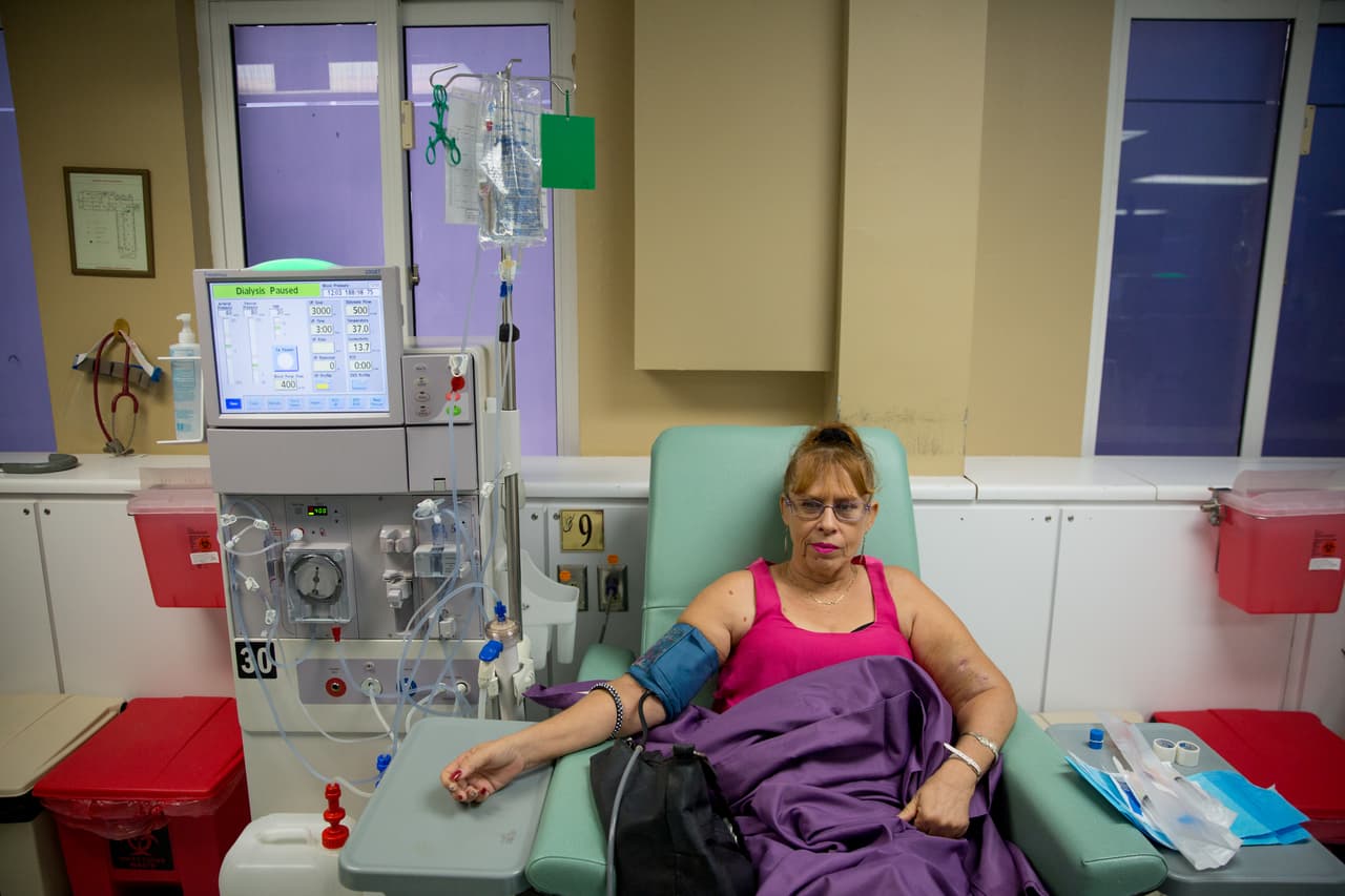 Esther Pabón es una paciente renal que dice que siente dolores de barriga. Con los problemas eléctricos y de surtido de agua le redujeron las horas de su diálisis.