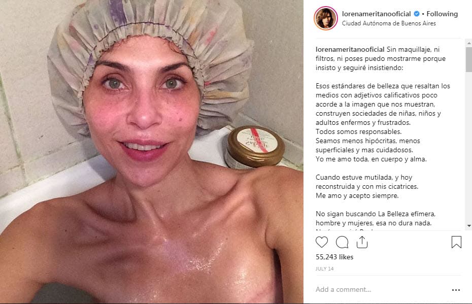 "Solo quien lo vivió y lo superó sabe de qué se trata esa guerra en la que entre más avanzas más parece que estás cerca de la muerte", explicó Meritano en Instagram junto a esta foto.