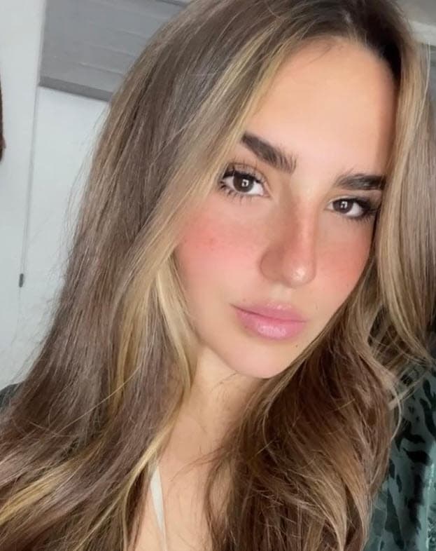 Sobre la salud de Valentina, Cecilia Galliano informó que ya está en recuperación. 
<br>