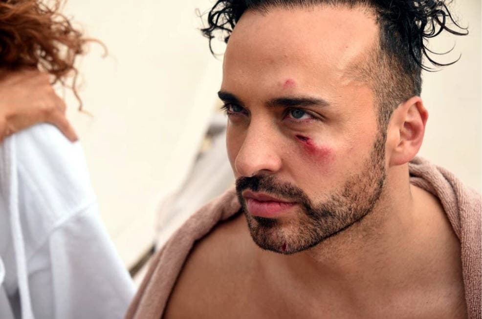 El accidente causó lesiones menores y moretones a Daniela Magún, Federica Quijano y André Quijano, siendo éste el más lastimado con
<b> un profundo corte en el pómulo izquierdo.</b>