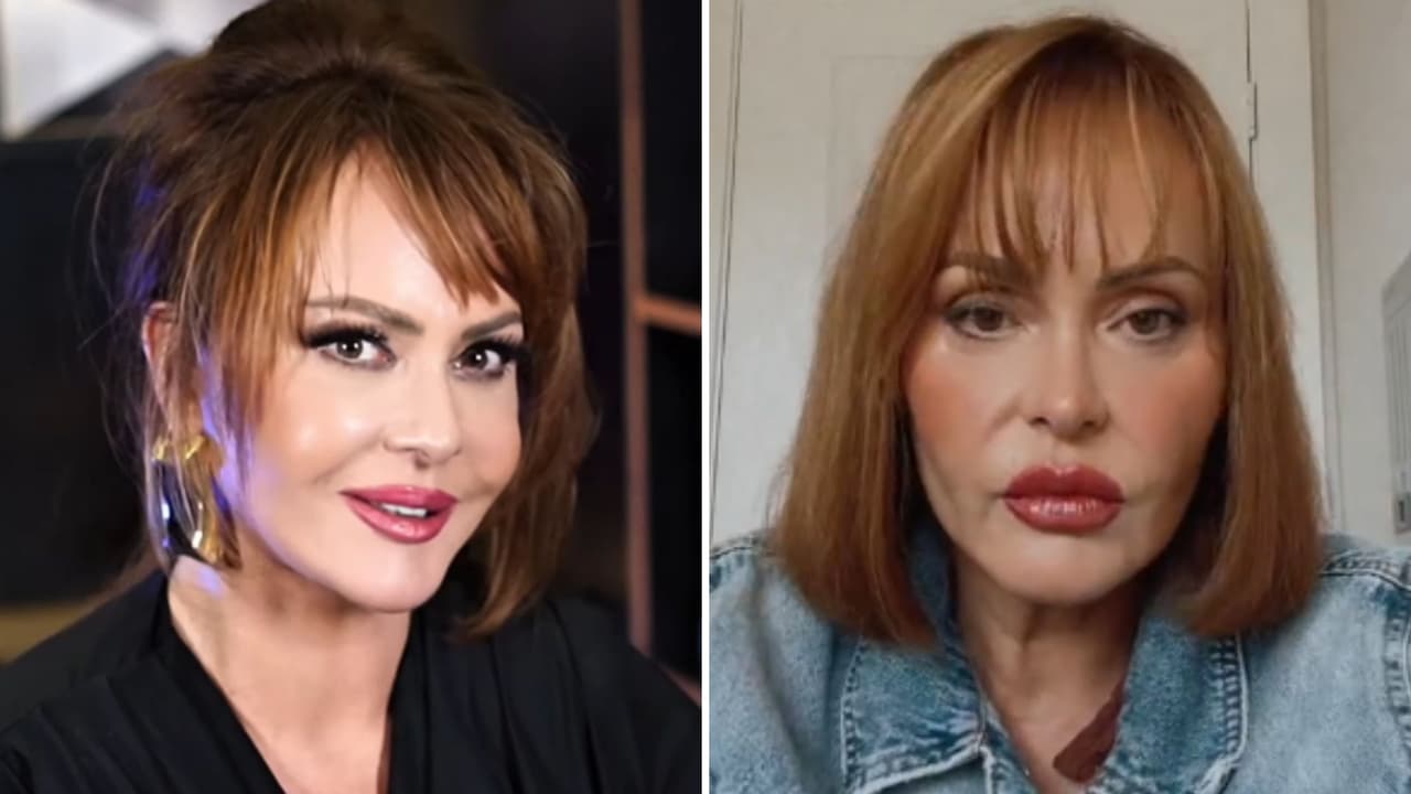 Gaby Spanic responde tras su cirugía facial a quien dice que hay que “envejecer con dignidad”