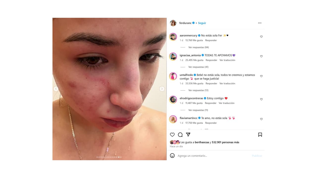 La influencer sigue un proceso legal en contra de su expareja.
