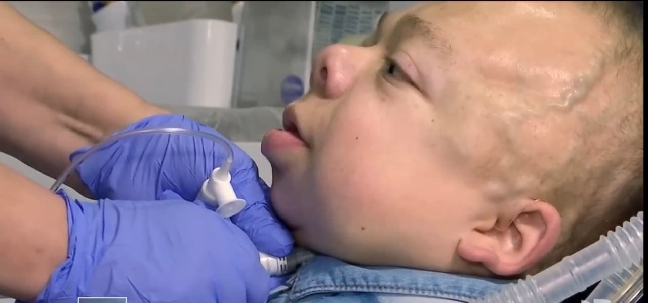 El joven de origen colombiano ha desafiado todos los pronósticos que estipulan que la mayoría de los niños que sufren esta enfermedad mueren al nacer o no llegan a cumplir los 10 años de edad.
<br>