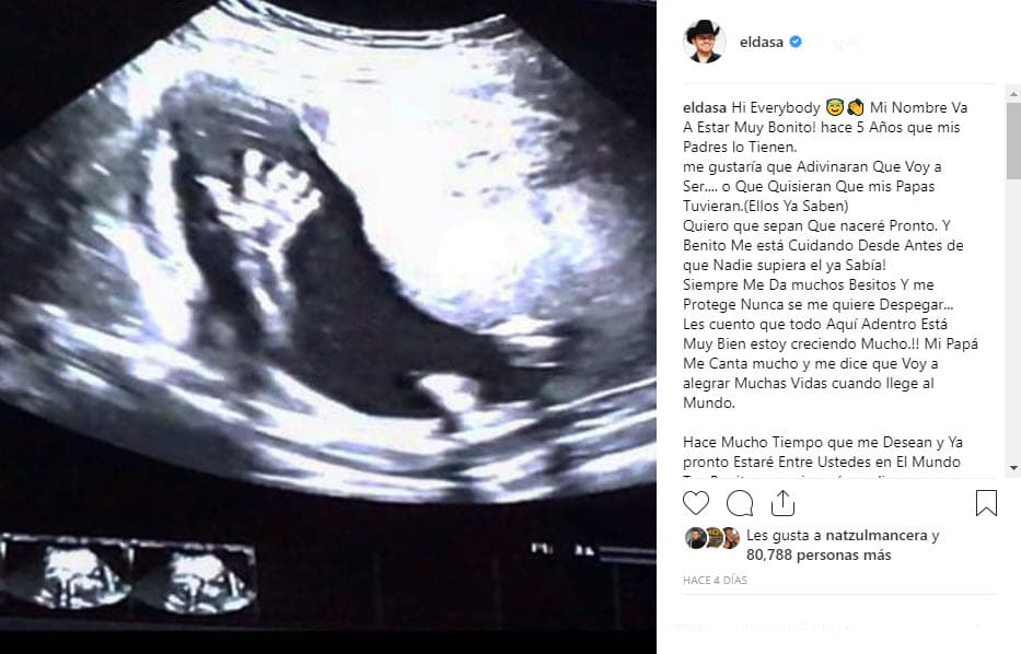 "Mi alegría más grande, lo que tanto soñaba, la emoción más bonita que mi cuerpo ha sentido en toda la vida. 
<b>¡Voy a ser papá!</b>", escribió en Instagram.
<br>