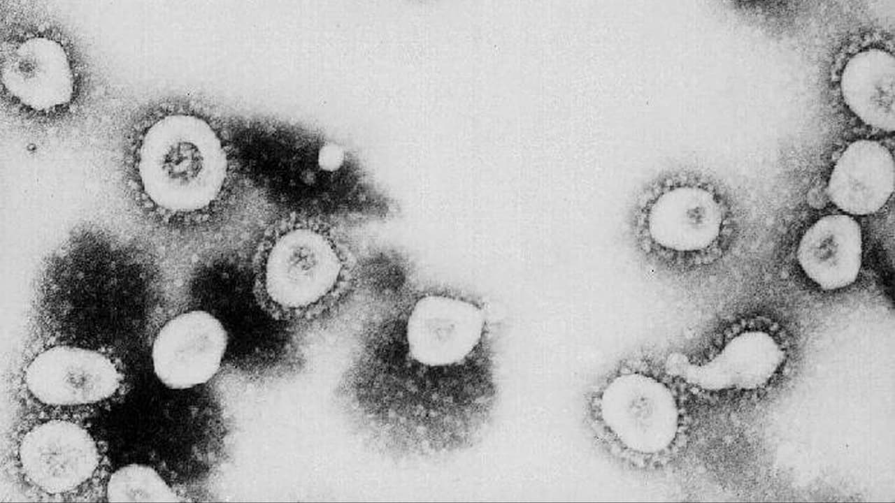 <b> Febrero 2020: </b>El Centro para el Control y Prevención de Enfermedades (CDC) confirmó el primer caso de coronavirus en Texas. Se trató de un paciente se encontraba entre un 
<a href="https://www.univision.com/local/san-antonio-kwex/llegan-a-la-base-lackland-en-san-antonio-las-250-desalojadas-de-china-por-coronavirus">grupo de personas bajo una orden federal de "cuarentena" en la base Lackland en Texas</a> debido a su reciente regreso a los Estados Unidos, en un vuelo fletado por el Departamento de Estado que llegó el 7 de febrero de 2020.