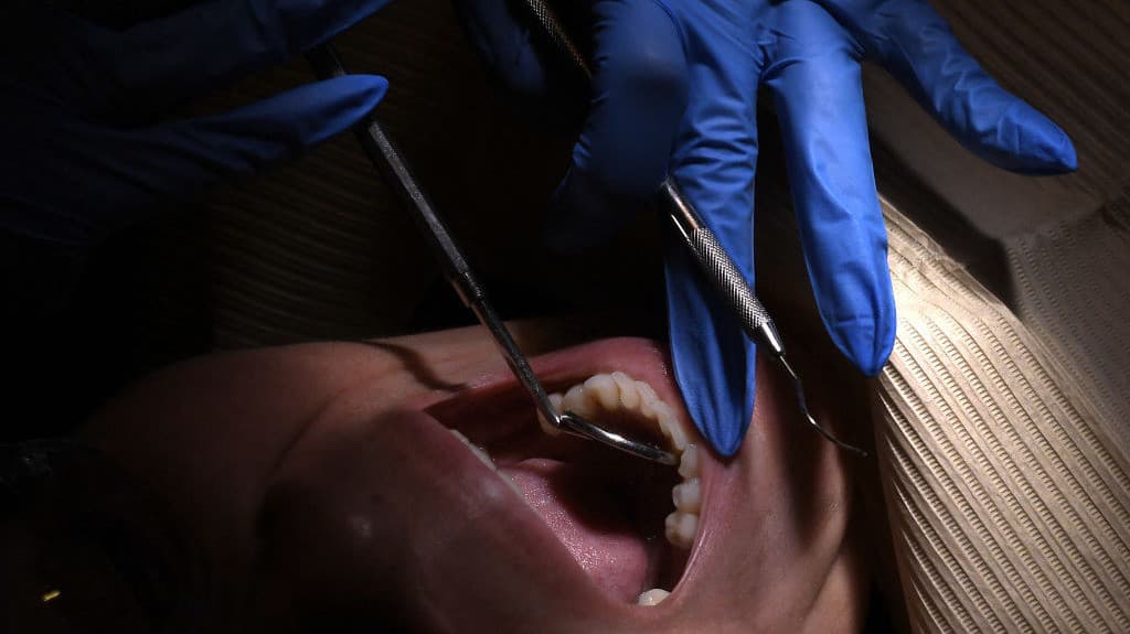 Aprende a reconocer los síntomas del cáncer oral
