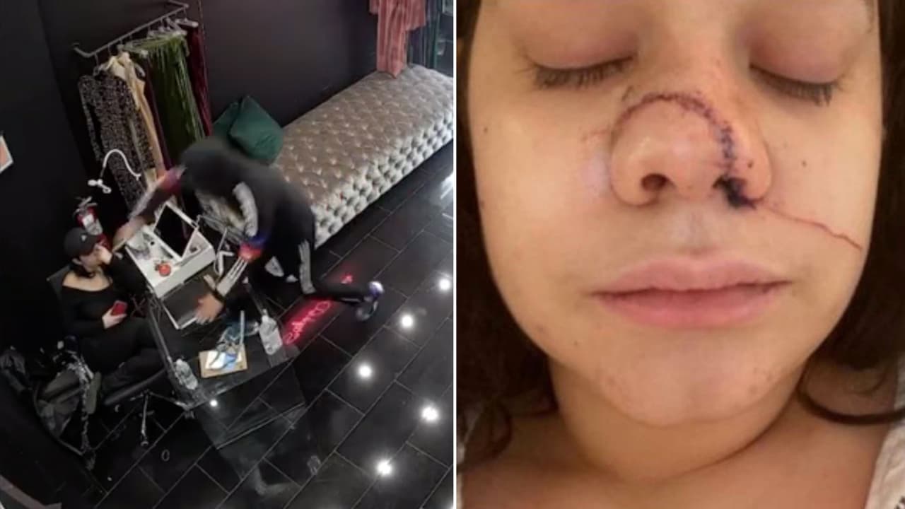 Buscan a sujeto que cortó la cara a empleada de una tienda en el Alto Manhattan