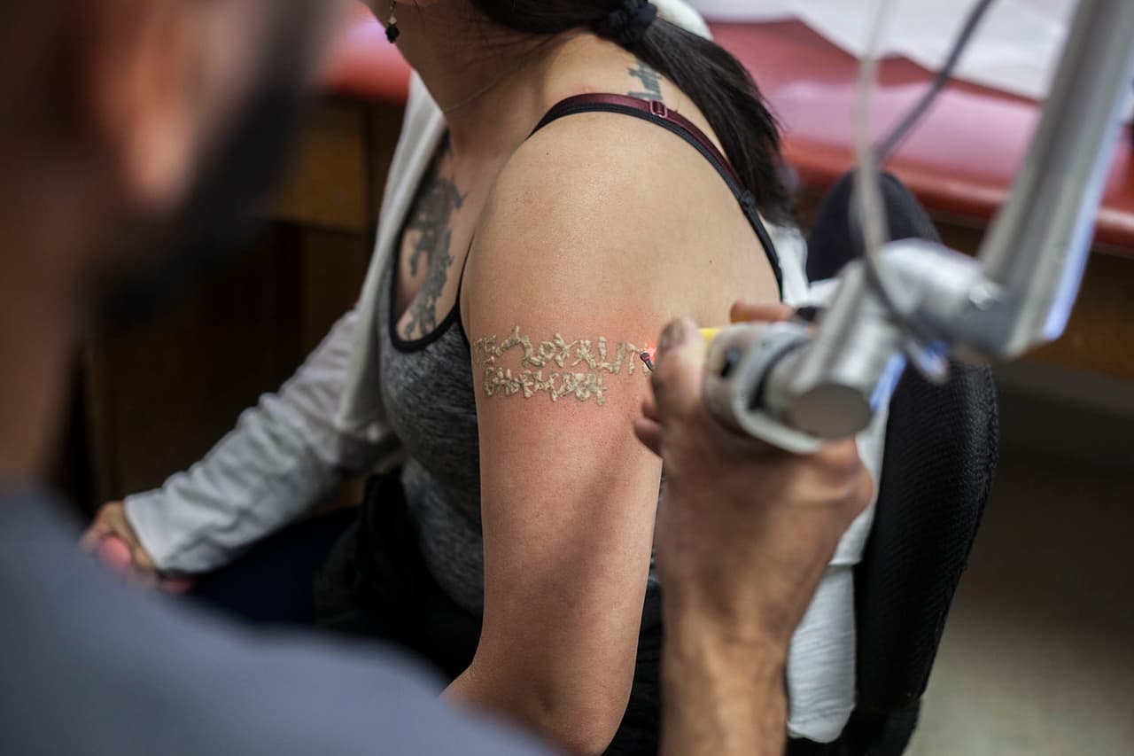 Con los cuidados necesarios, sin que les dé el sol y evitando a toda costa rascarse la cicatriz, los tatuajes desapareceran completamente.