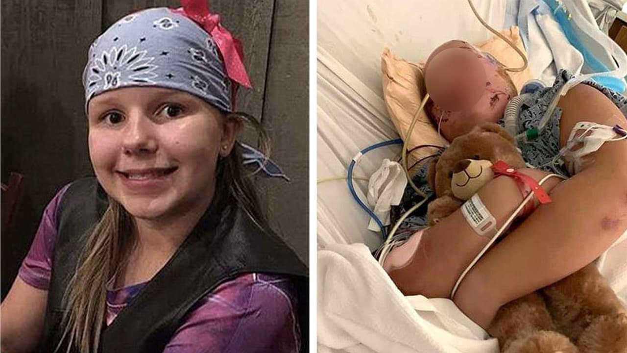 Joslyn Stinchcomb, de 15 años, fue brutalmente atacada por dos perros de la raza pitbulls mientras caminaba por su vecindario en Winder cerca de Bowman Mill Road NorthEast el condado de Barrow.