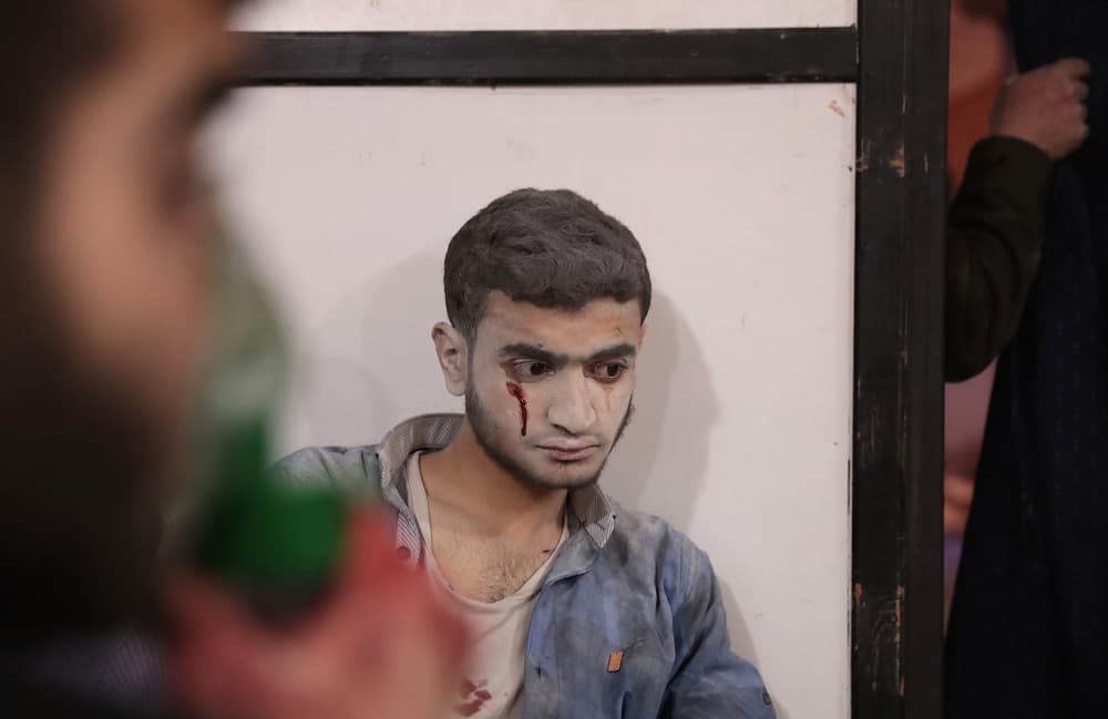 El supuesto ataque químico se produjo horas después de que al menos 44 personas murieran y 170 resultaron heridas por ataques aéreos y de artillería contra distintas zonas de la región de Guta Oriental, el principal bastión opositor de las afueras de Damasco, según el Observatorio.