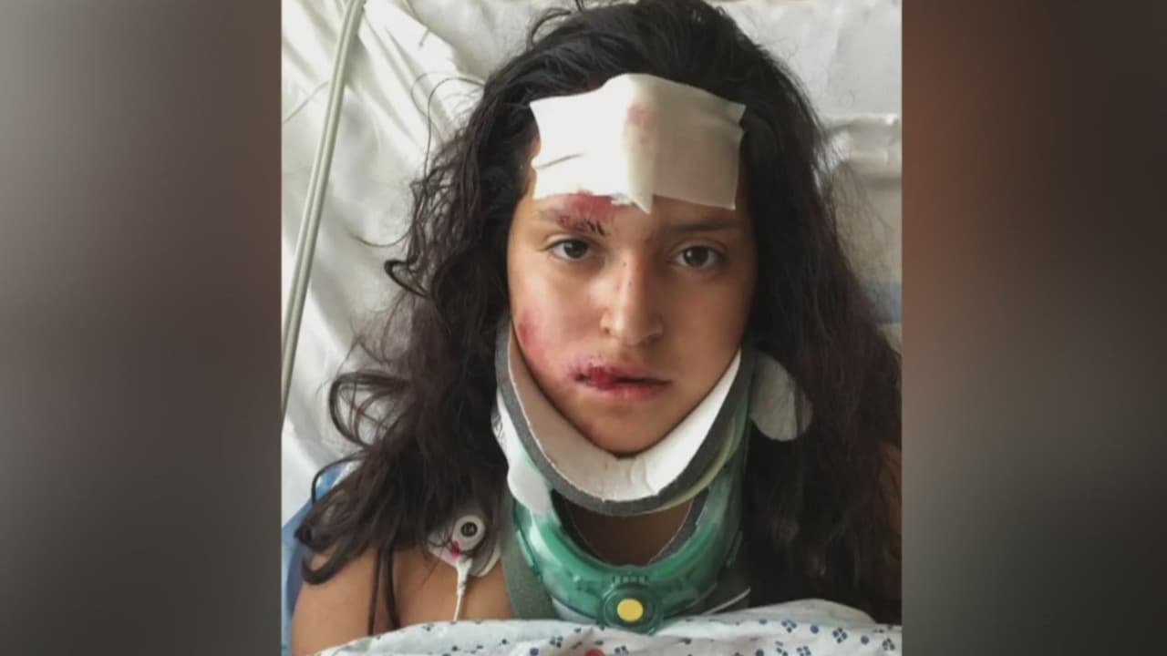 La hispana herida en el atropello en Charlottesville tiene una fractura en el cráneo