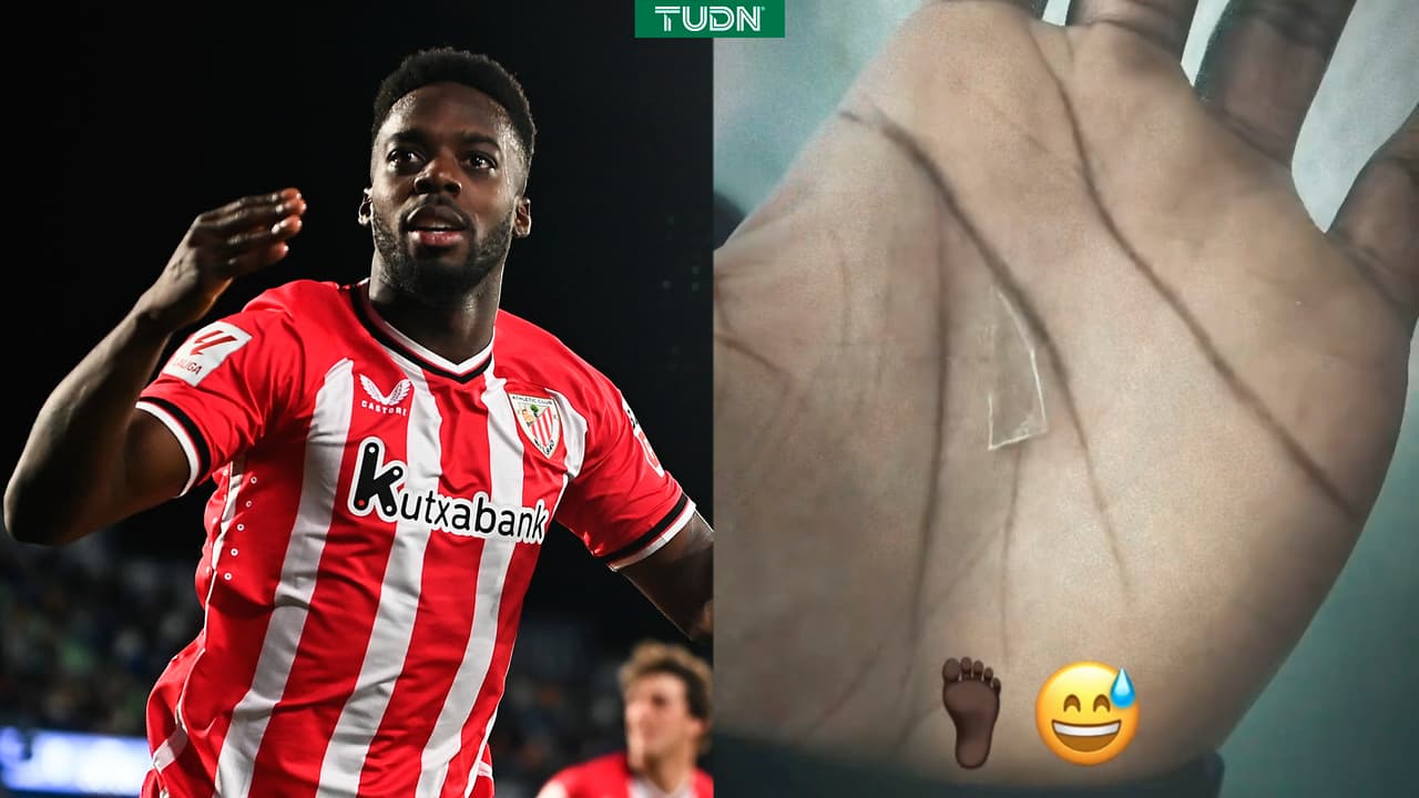 ¡Insólito! Iñaki Williams jugó dos años con un cristal dentro del pie