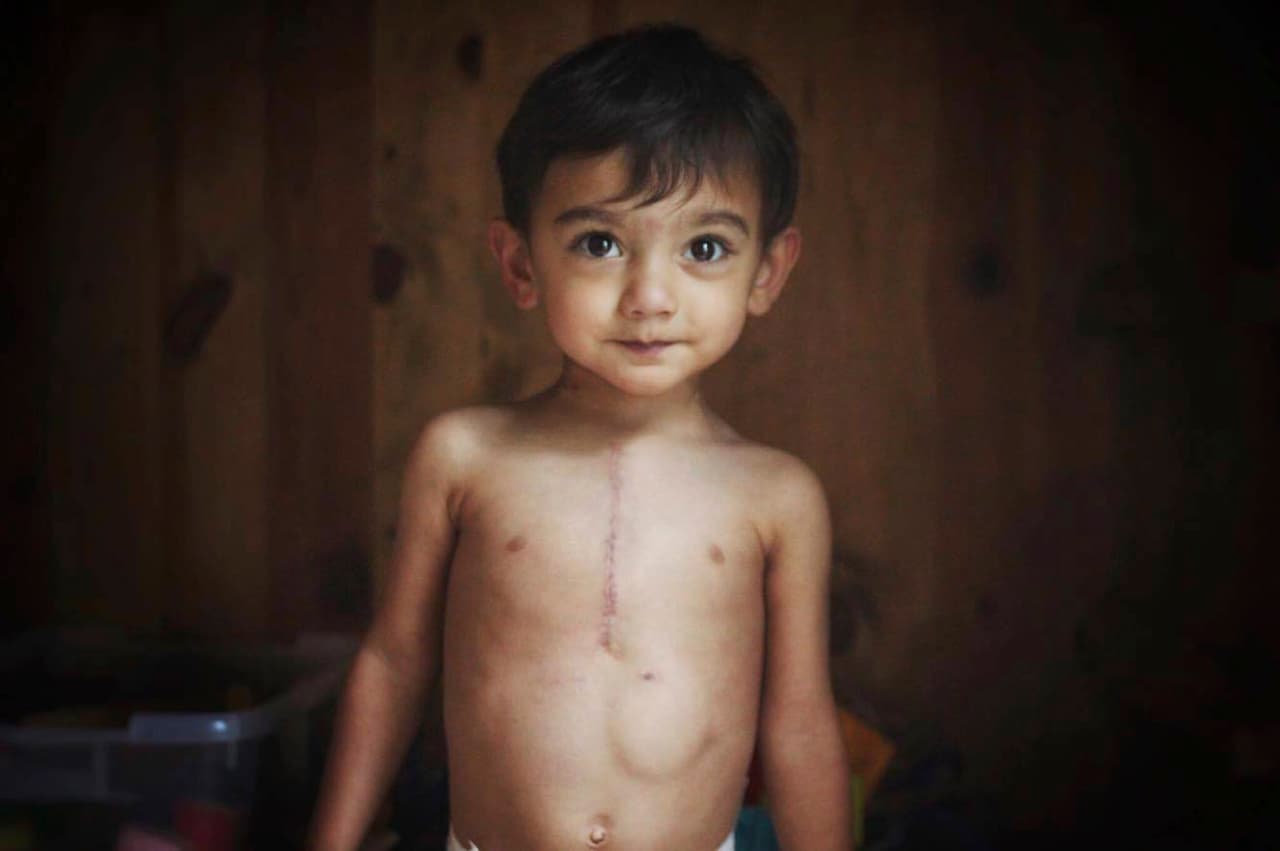 <b>"Fue como si me sacaran el aire". </b>Cuando supo que el proyecto de ley de salud republicano del Senado 
<a href="http://www.univision.com/noticias/politica/obamacare-sigue-con-vida-los-republicanos-tambien-fracasan-en-su-intento-de-derogar-la-ley-de-salud">había fracasado</a> por el momento, Alison Chandra lloró de la felicidad. Era un gran alivio: podría seguir costeando las facturas médicas de su hijo de 3 años, Ethan, quien tiene el síndrome de heterotaxia, un desorden genético que hace que los órganos se desarrollen en lugares equivocados. La alegría duró poco. 
<b>Al poco tiempo se enteró de que el plan de los conservadores era <a href="http://www.univision.com/noticias/politica/trump-pide-a-los-republicanos-derogar-obamacare-tras-el-nuevo-fracaso-en-el-intento-de-aprobar-otra-ley-de-salud">derogar de inmediato sin un remplazo</a></b>. "Sentí como si me sacaran el aire", admite la residente de Middlesex, New Jersey.