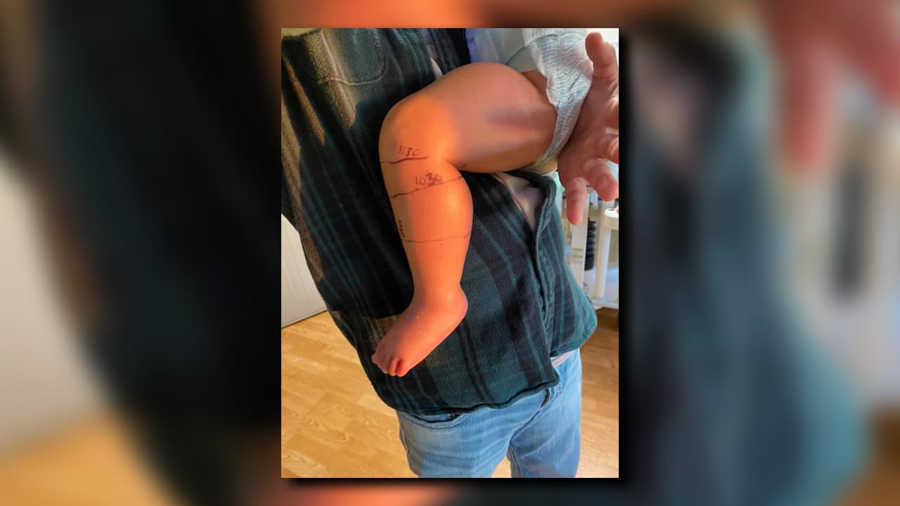 “Por favor, revise los juguetes de sus hijos antes de que salgan a jugar”, dijo la mamá de la pequeña en una publicación en Facebook.