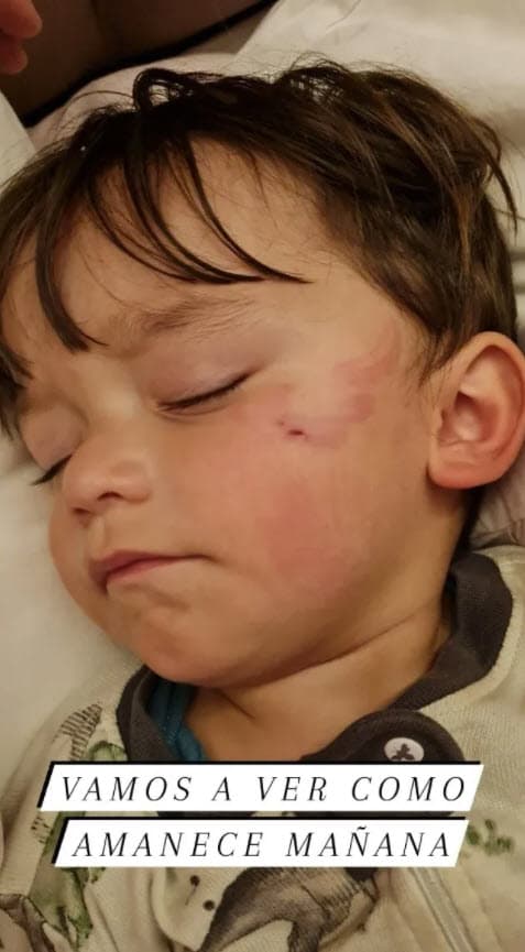 Sin embargo, la artista fue duramente criticada. Hubo quienes aseguraron que ella justificó el comportamiento del animal por encima de lo sucedido a su hijo al decir que el niño no debe ser tan "intensito" con la mascota.
<br>