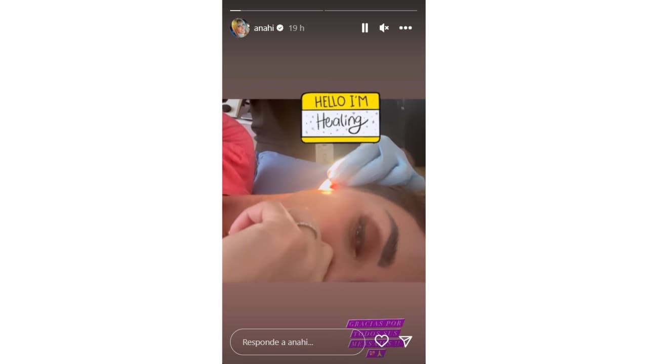 Anahí tras su accidente.