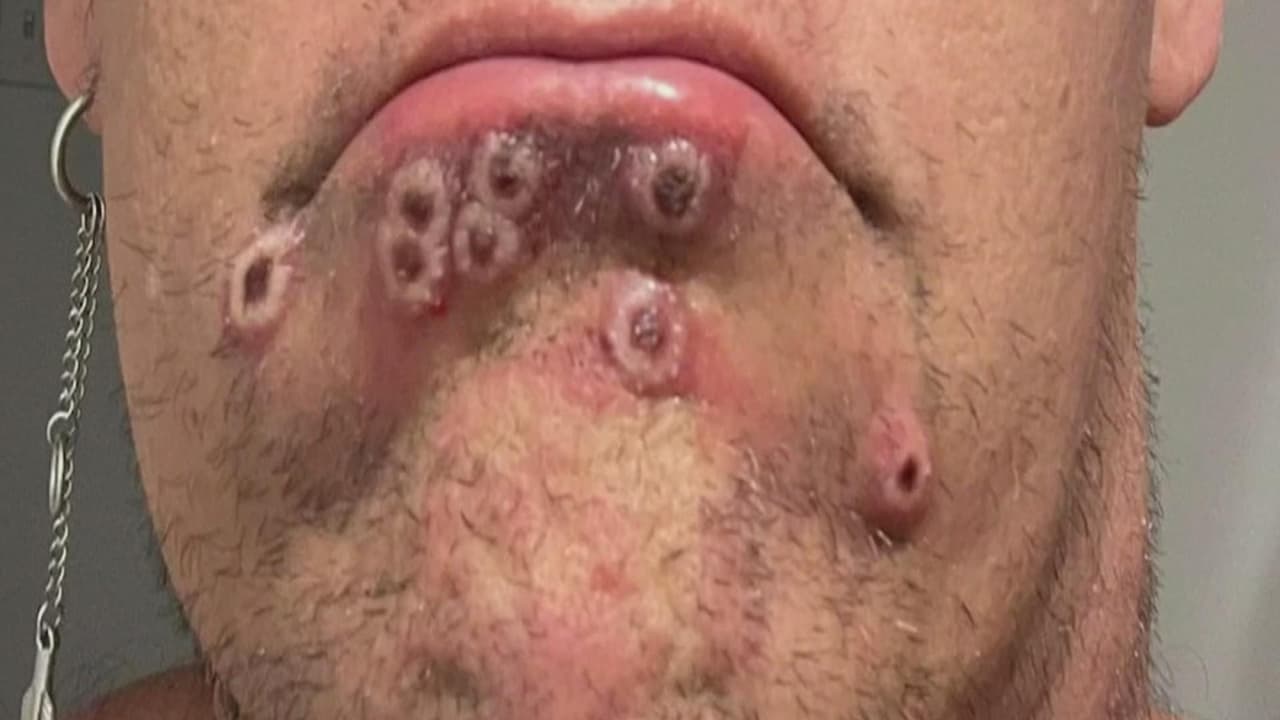 <b>¿El virus se conserva en el agua, la comida, superficies y hasta en el refrigerador?</b>
<br>
<br>Del Río dice que sí. Sin embargo, aclara que “una cosa es lo que puede y otra lo que causa”. Aclarando que si bien el virus permanece activo en superficies, por horas y días, no implica que tenga la suficiente potencia de contagio.
<br>