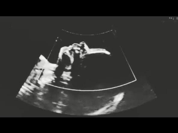 Fue apenas el 16 de abril de este año cuando anunció, a través de Instagram, que 
<a href="https://www.instagram.com/p/BwVsv7ulkSq/" target="_blank">esperaba a su primera hija</a>.