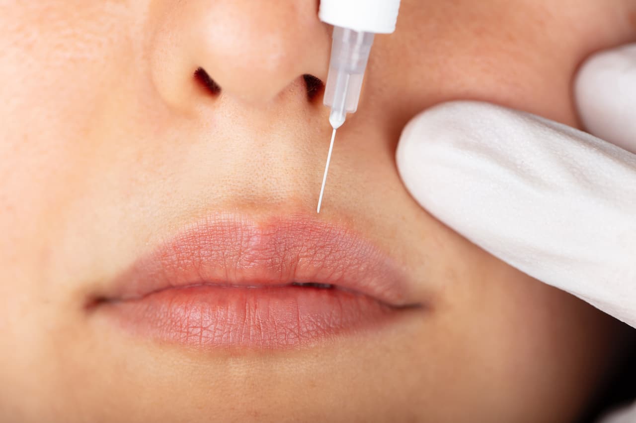 <h3 class="cms-H3-H3">25. Botox</h3>
<br>
<br>La doctora canadiense Jean Carruthers fue uno de los primeros médicos en utilizar la toxina botulínica, que puede paralizar los músculos faciales, con fines médicos en Canadá. 
<br>
<br>Después de tratar a pacientes con múltiples espasmos de párpados con inyecciones que detuvieron sus espasmos, Carruthers vio que los rostros de los pacientes también estaban serenos y libres de arrugas. Junto con su esposo, el dermatólogo Alastair Carruthers, fue pionera en el concepto de usar botox con fines cosméticos.
<br>