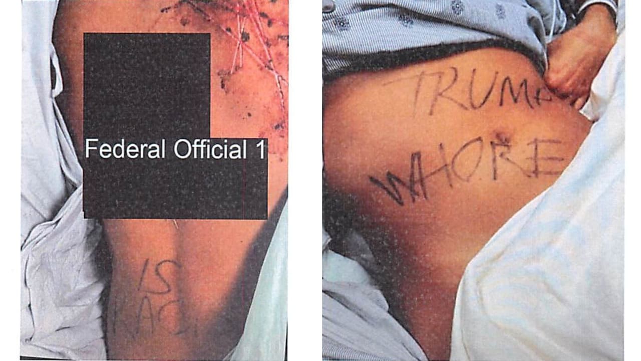 Izquierda: Referencia a un funcionario Federal 1, cuya identidad se mantiene confidencial en los documentos judiciales. Derecha: Referencia a Donald Trump. Greene afirmó falsamente que fue atacada debido a su empleo con el funcionario federal, y los agresores supuestamente escribieron mensajes políticos en su cuerpo, incluyendo referencias a Trump y acusaciones de racismo contra su empleador.