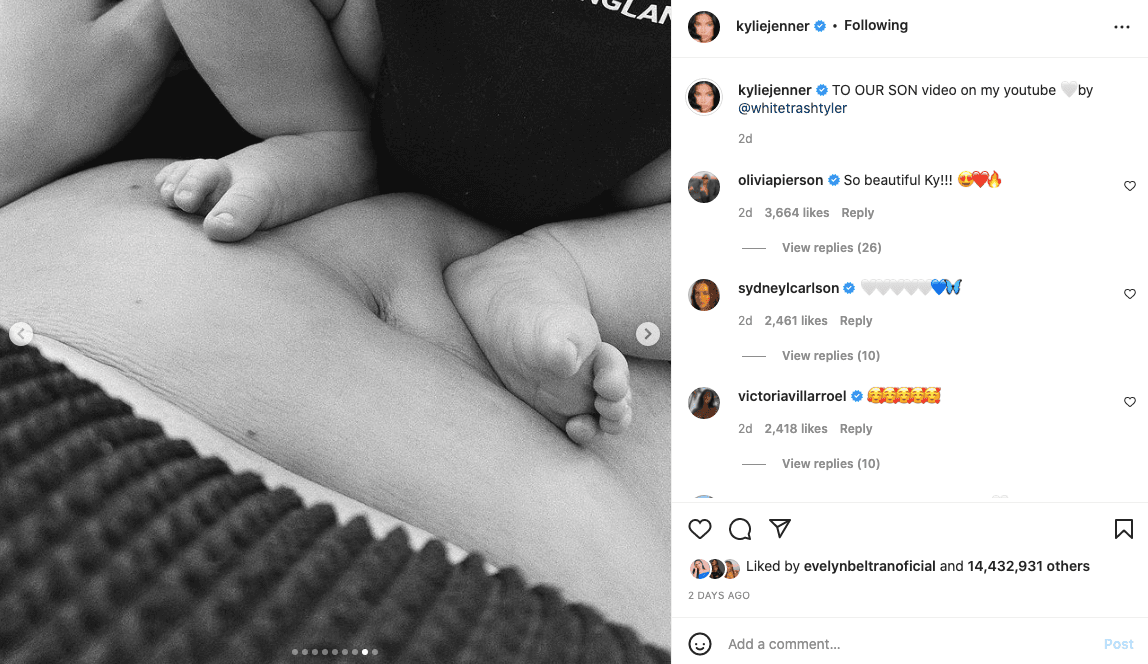 Kylie Jenner mostró su abdomen postparto con una tierna foto