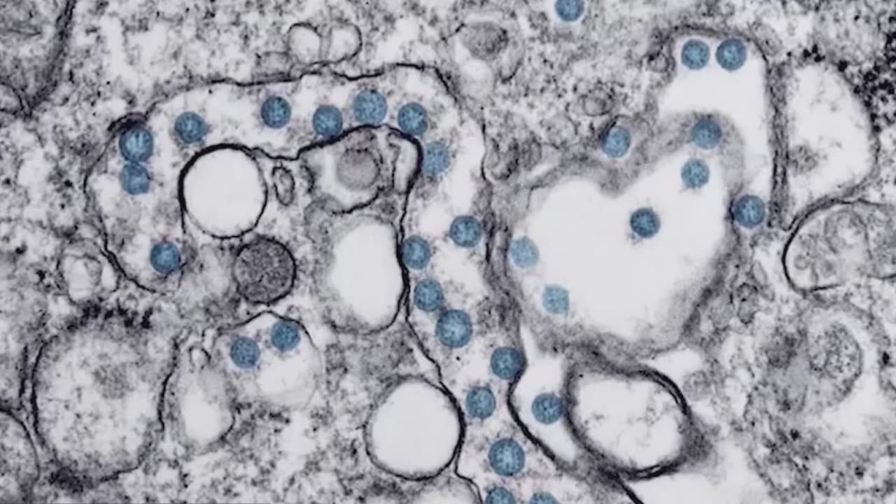 La variante Mu, la nueva cepa del coronavirus está en Arizona 