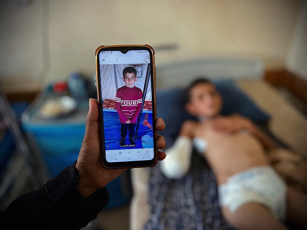 El niño Musa Al-Shaer yace en una cama en Rafah, Gaza. Un proyectil de tanque lo alcanzó cuando buscaba harina para su familia. Sufrió la amputación de la mano derecha y lesiones graves en la columna vertebral.