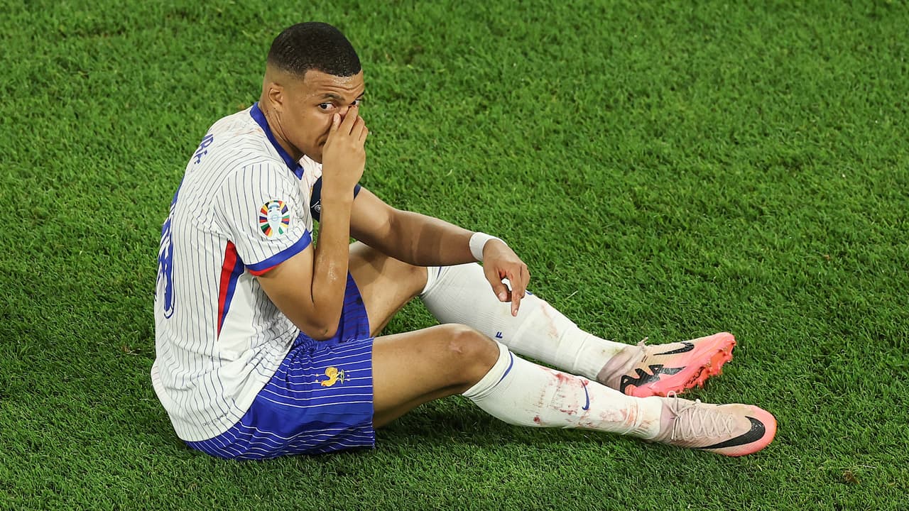 Mbappé toma con humor de "tortuga ninja" su fractura