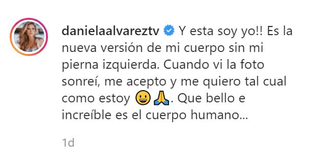 "¡Esta soy yo! Es la nueva versión de mi cuerpo sin mi pierna izquierda", escribió al inicio de su mensaje.