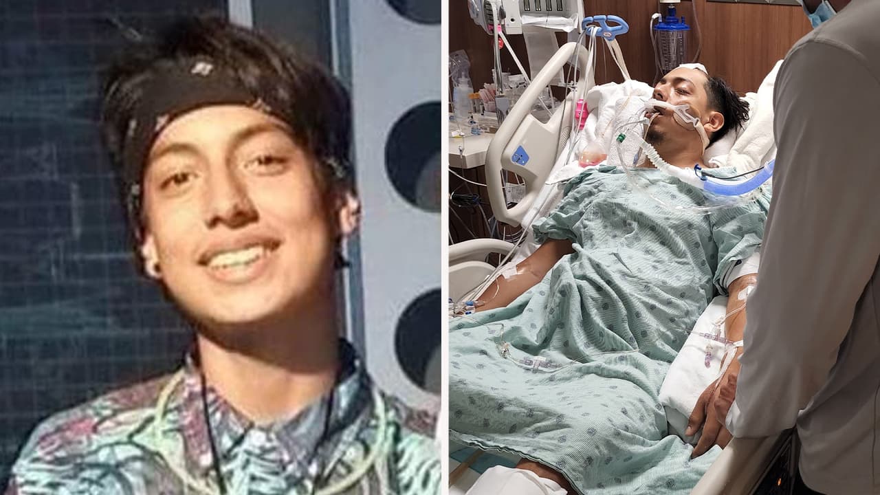 Dos conductores atropellan a Eduardo Favela, motociclista hispano que ahora lucha por su vida en Houston 