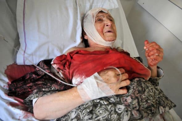 Una mujer libanesa herida yace en una cama de un hospital.