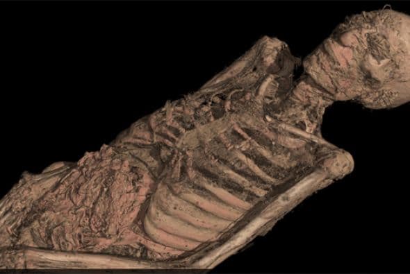 Los investigadores también observaron los músculos e incluso las arterias. Notaron que algunas parecían obstruidas con depósitos de grasa. (Crédito: British Museum)