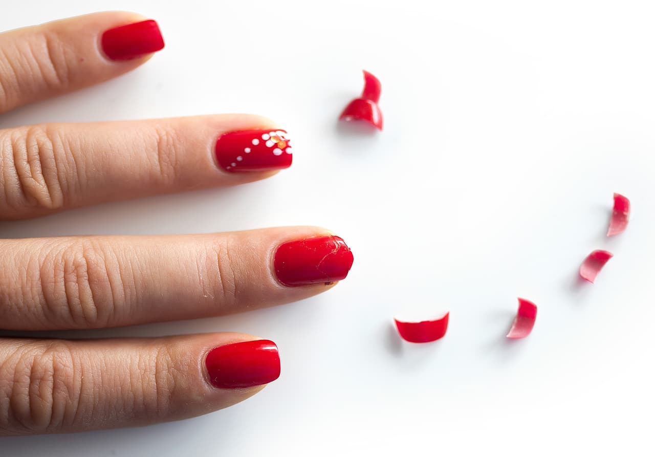 Aunque las causas anteriores son las más comunes, también puede haber otras mayores, como es el caso de la anemia, la cual debilita las uñas debido a la disminución de hemoglobina circulante, misma que hace que la cantidad de oxígeno en los tejidos disminuya, alterando de esta manera a las uñas.