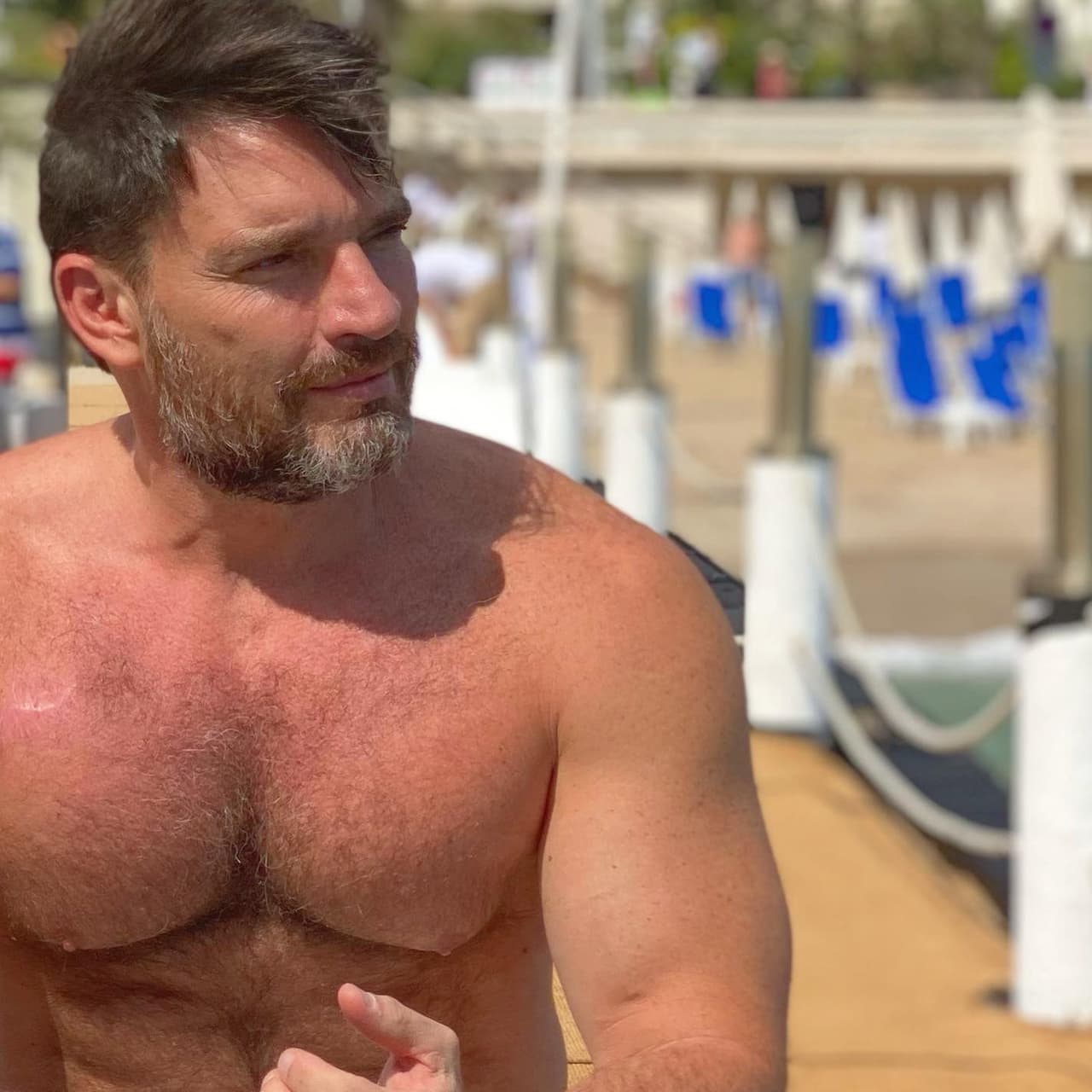 Julián considera que “el exceso de sol” le ocasionó la enfermedad, ya que desde que vivía en Puerto Rico “siempre quería estar negro, achicharrado”. 
<br>