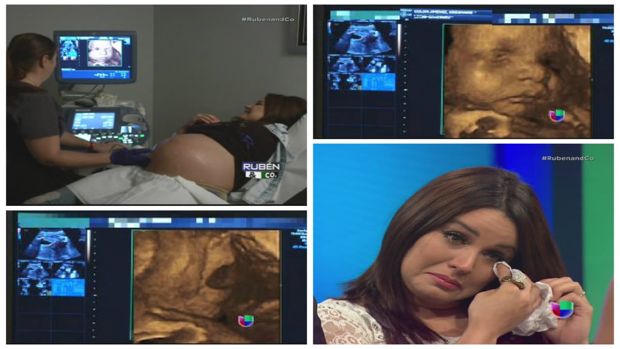 En Rubén & Co pudimos ver en 4D a #BabyCompany, la pequeña Kamilia que está en la barriguita de Gredmarie