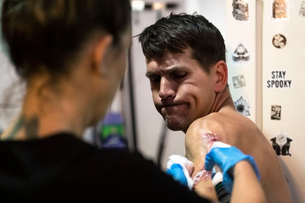 El Departamento de Salud y la Junta de Salud de Filadelfia admitieron en un comunicado que “ 
<b>la xilazina ha golpeado a Filadelfia de una manera particularmente fuerte</b>, causando un aumento de las muertes por sobredosis, así como heridas graves que pueden causar sepsis y amputación”.
<br>