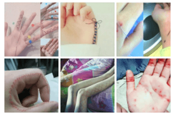 Imágenes de diseños realizados por los adolescentes chinos cosiéndose el cuerpo