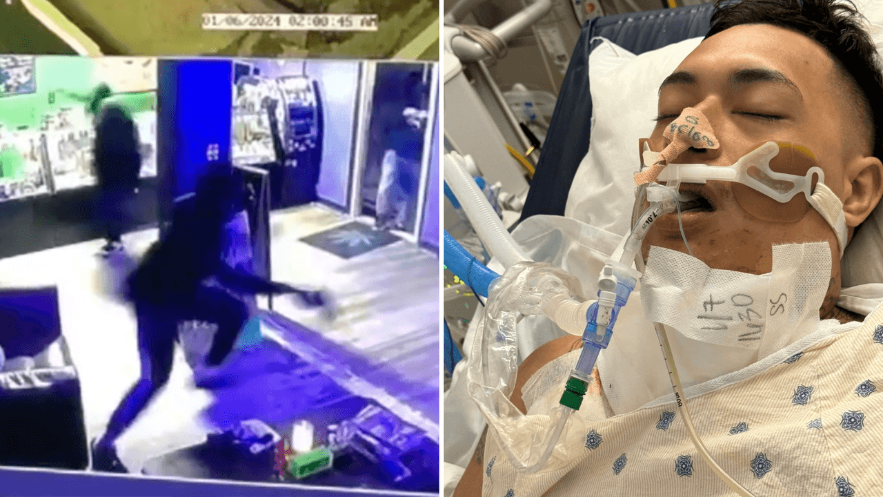 Guardia de seguridad termina baleado luego de enfrentamiento con presuntos ladrones